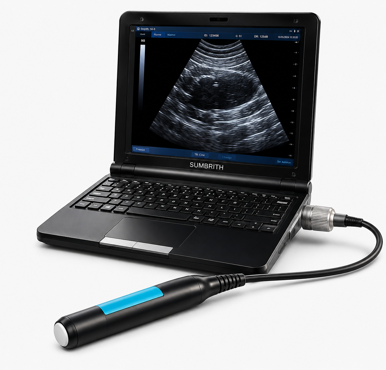 Ultrassom Portátil 802S Sumbrith Veterinário